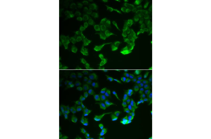 Immunofluorescence - Anti-C1R Antibody (A6360) - Antibodies.com