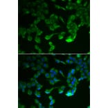 Immunofluorescence - Anti-C1R Antibody (A6360) - Antibodies.com