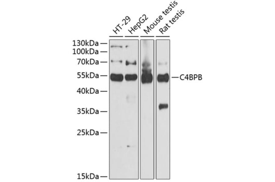 Western Blot - Anti-C4 binding protein/C4BPB Antibody (A11966) - Antibodies.com