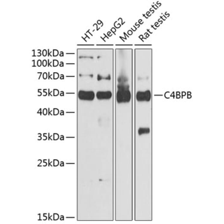 Western Blot - Anti-C4 binding protein/C4BPB Antibody (A11966) - Antibodies.com
