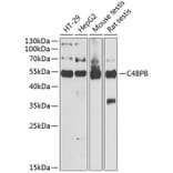 Western Blot - Anti-C4 binding protein/C4BPB Antibody (A11966) - Antibodies.com