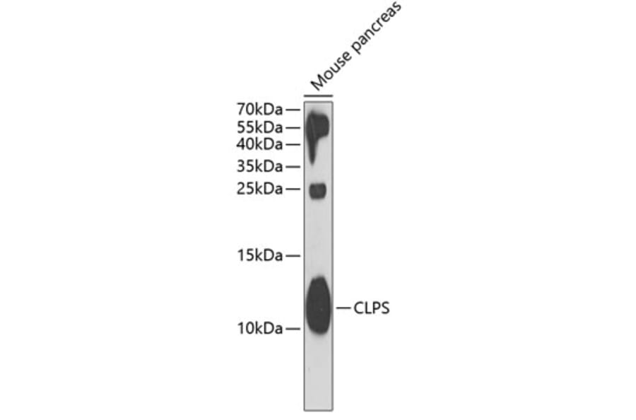 Western Blot - Anti-CLPS Antibody (A11967) - Antibodies.com