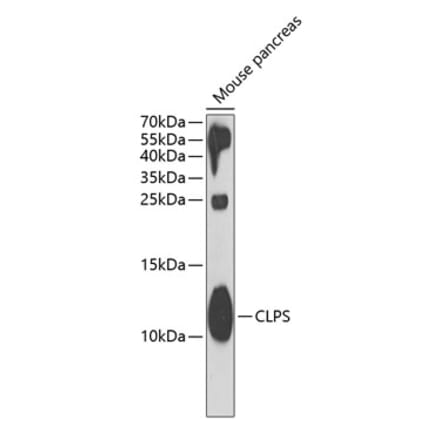 Western Blot - Anti-CLPS Antibody (A11967) - Antibodies.com