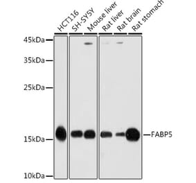 Western Blot - Anti-FABP5 Antibody (A11968) - Antibodies.com