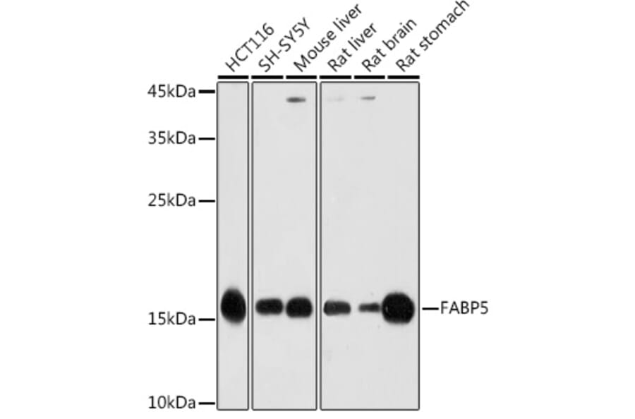 Western Blot - Anti-FABP5 Antibody (A11968) - Antibodies.com