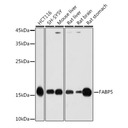 Western Blot - Anti-FABP5 Antibody (A11968) - Antibodies.com