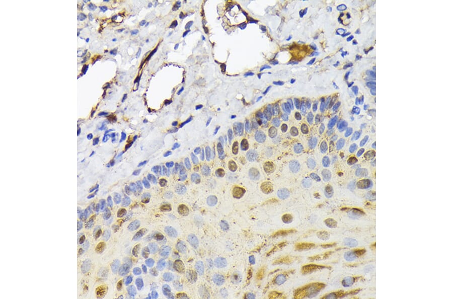 Immunohistochemistry - Anti-FABP5 Antibody (A11968) - Antibodies.com