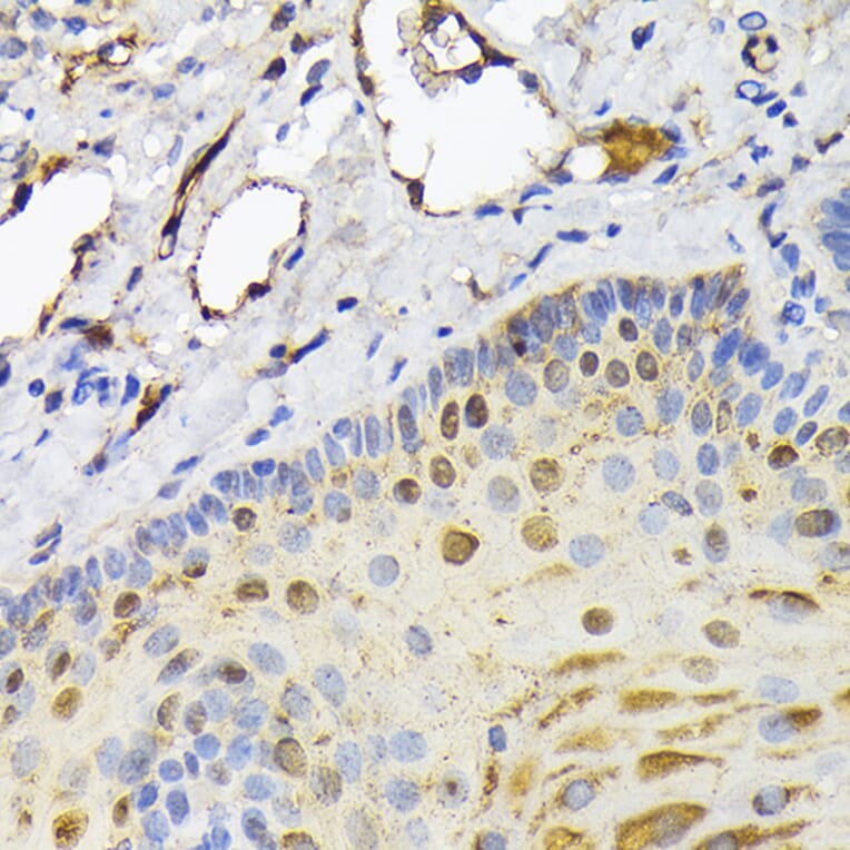 Immunohistochemistry - Anti-FABP5 Antibody (A11968) - Antibodies.com