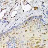 Immunohistochemistry - Anti-FABP5 Antibody (A11968) - Antibodies.com