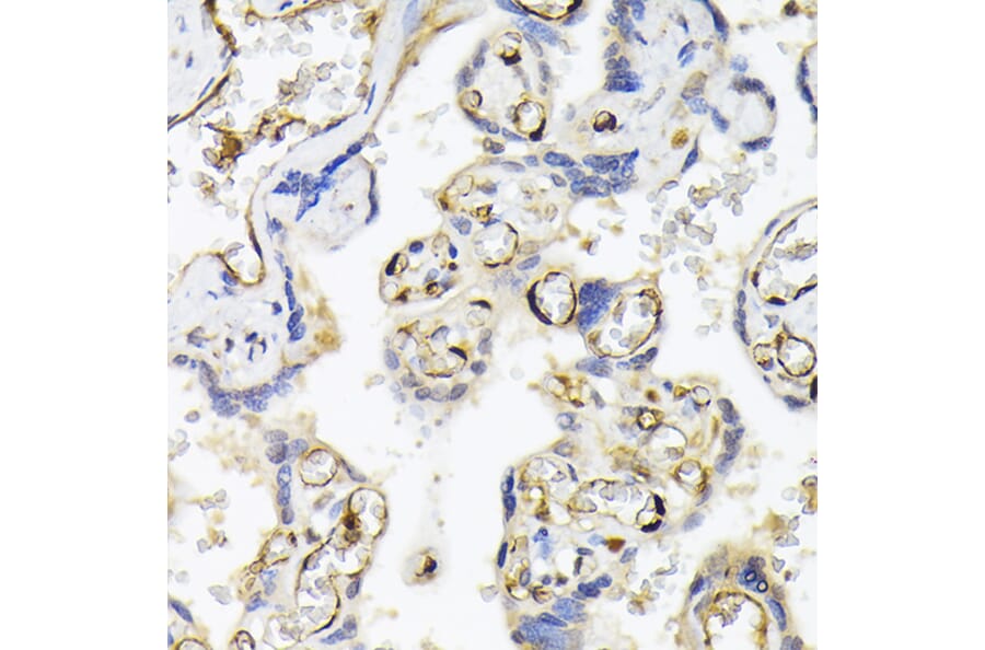 Immunohistochemistry - Anti-FABP5 Antibody (A11968) - Antibodies.com