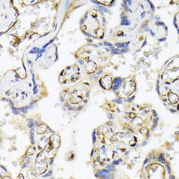 Immunohistochemistry - Anti-FABP5 Antibody (A11968) - Antibodies.com