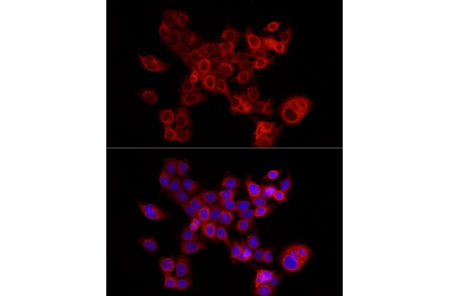 Immunofluorescence - Anti-FABP5 Antibody (A11968) - Antibodies.com