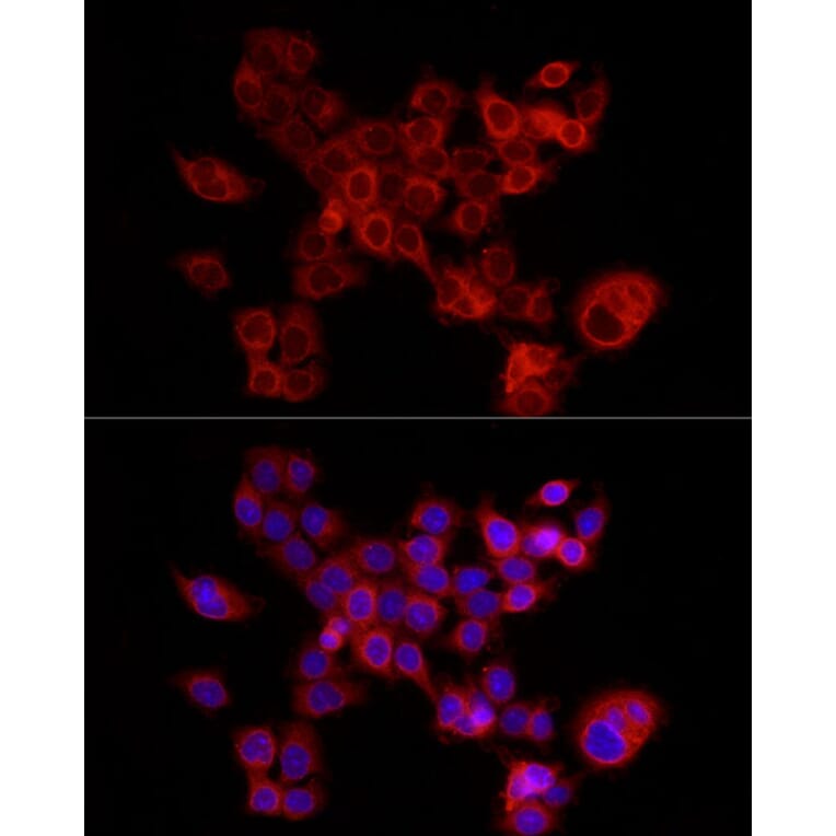 Immunofluorescence - Anti-FABP5 Antibody (A11968) - Antibodies.com