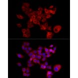 Immunofluorescence - Anti-FABP5 Antibody (A11968) - Antibodies.com