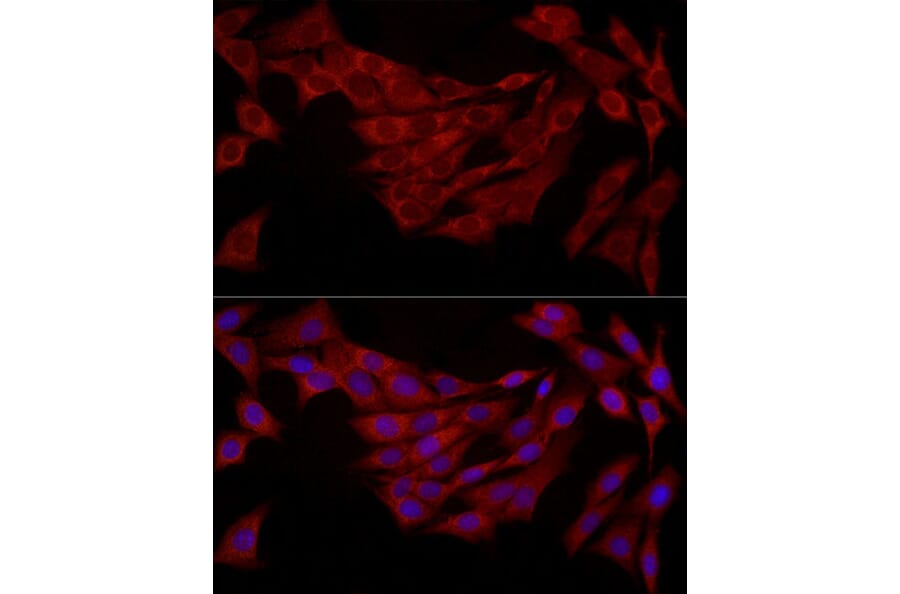 Immunofluorescence - Anti-FABP5 Antibody (A11968) - Antibodies.com