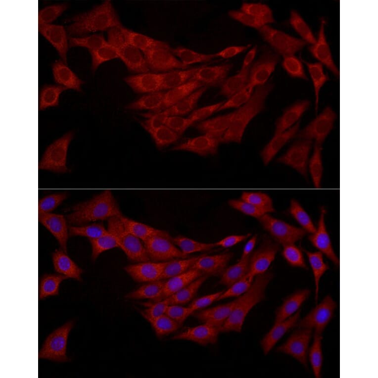 Immunofluorescence - Anti-FABP5 Antibody (A11968) - Antibodies.com