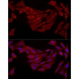 Immunofluorescence - Anti-FABP5 Antibody (A11968) - Antibodies.com