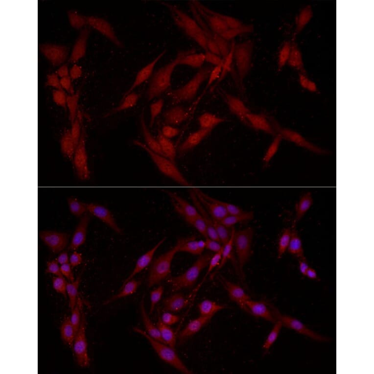 Immunofluorescence - Anti-FABP5 Antibody (A11968) - Antibodies.com