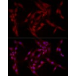 Immunofluorescence - Anti-FABP5 Antibody (A11968) - Antibodies.com