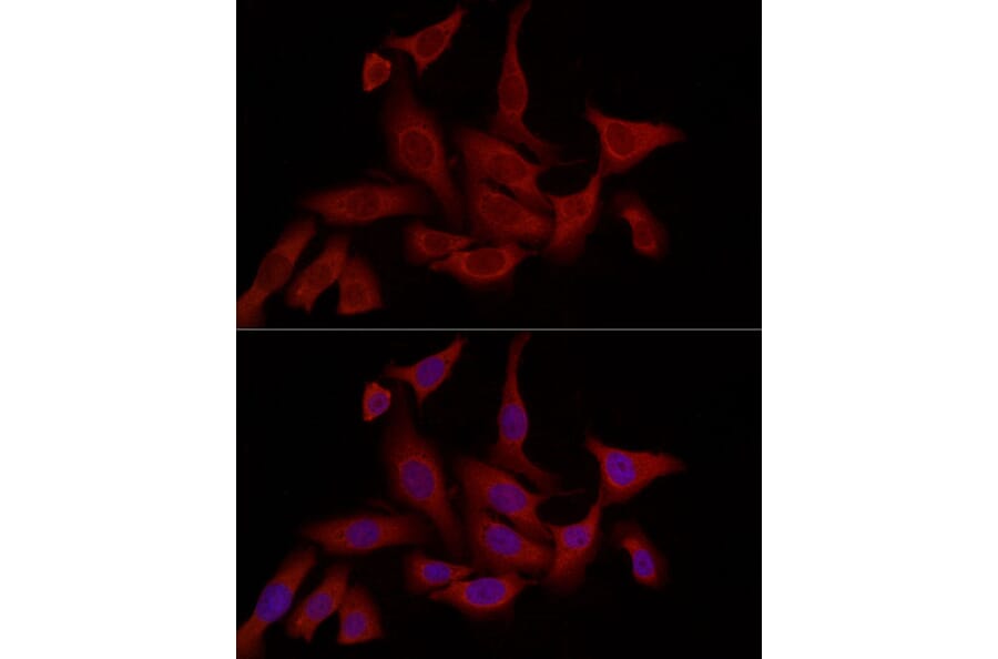 Immunofluorescence - Anti-FABP5 Antibody (A11968) - Antibodies.com