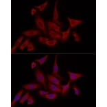 Immunofluorescence - Anti-FABP5 Antibody (A11968) - Antibodies.com