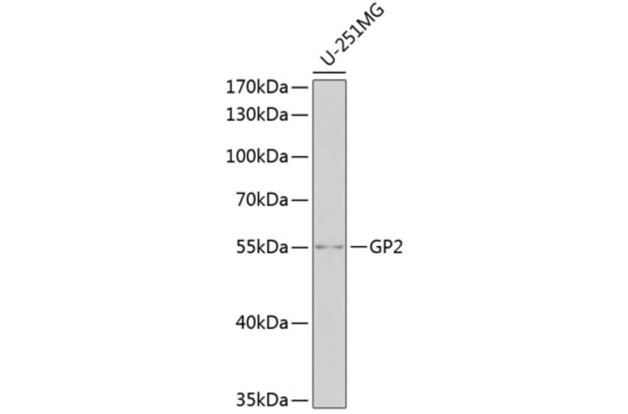 Western Blot - Anti-GP2 Antibody (A11969) - Antibodies.com