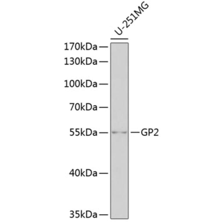 Western Blot - Anti-GP2 Antibody (A11969) - Antibodies.com
