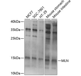 Western Blot - Anti-Motilin Antibody (A11970) - Antibodies.com