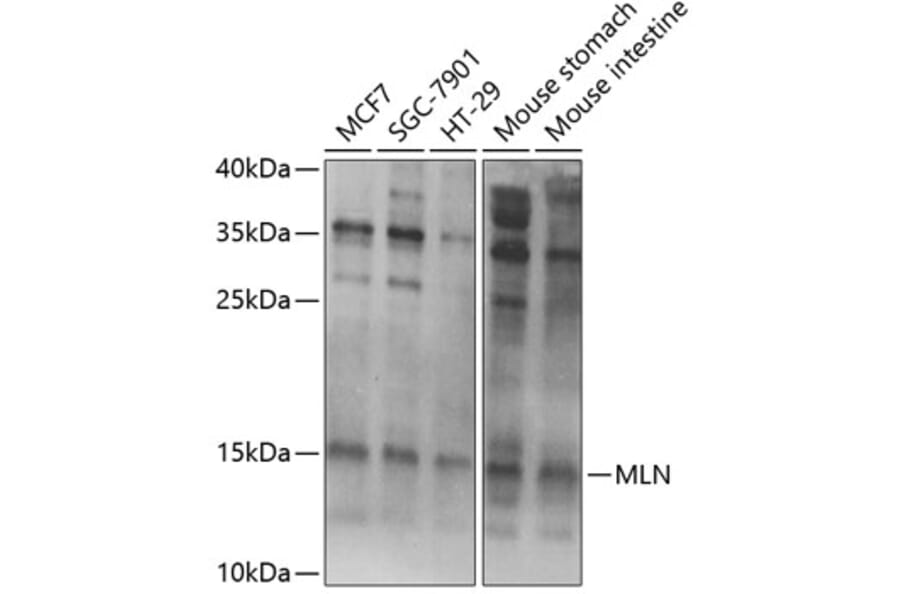 Western Blot - Anti-Motilin Antibody (A11970) - Antibodies.com