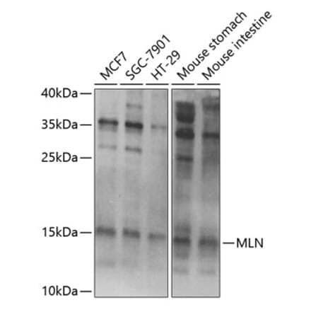 Western Blot - Anti-Motilin Antibody (A11970) - Antibodies.com