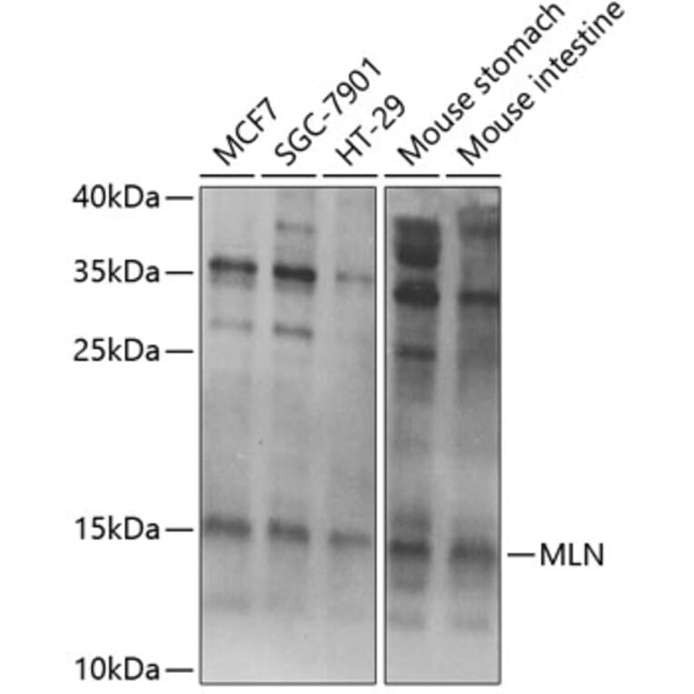 Western Blot - Anti-Motilin Antibody (A11970) - Antibodies.com