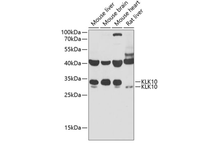Western Blot - Anti-Kallikrein 10/K10 Antibody (A11971) - Antibodies.com