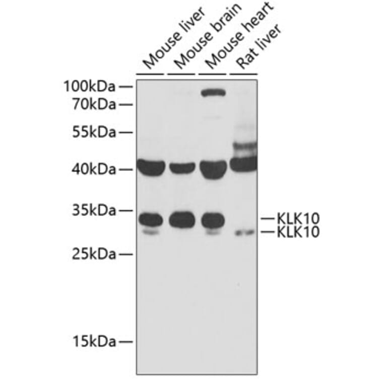 Western Blot - Anti-Kallikrein 10/K10 Antibody (A11971) - Antibodies.com