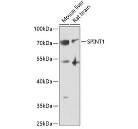 Western Blot - Anti-HAI-1 Antibody (A11972) - Antibodies.com