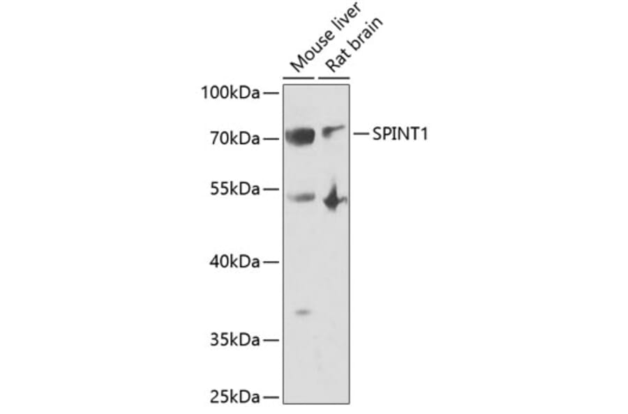 Western Blot - Anti-HAI-1 Antibody (A11972) - Antibodies.com