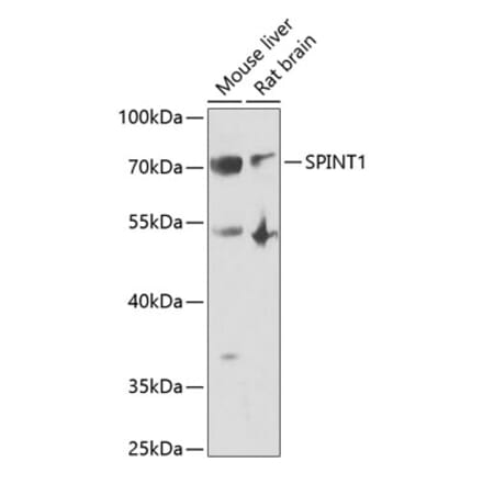 Western Blot - Anti-HAI-1 Antibody (A11972) - Antibodies.com