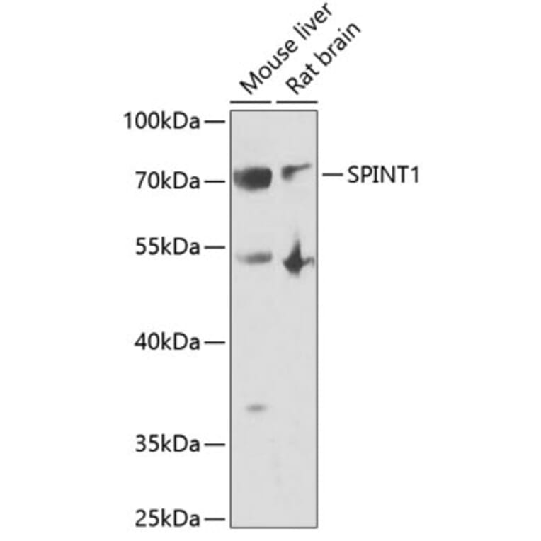 Western Blot - Anti-HAI-1 Antibody (A11972) - Antibodies.com