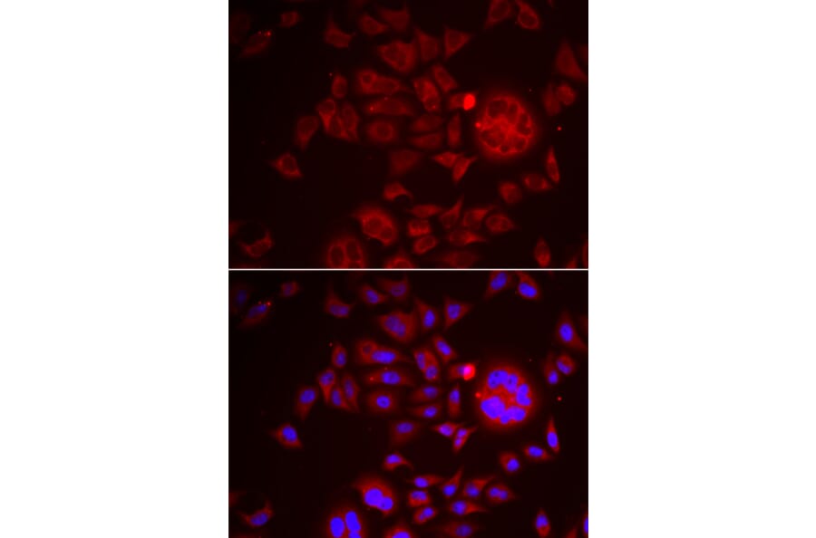 Immunofluorescence - Anti-HAI-1 Antibody (A11972) - Antibodies.com