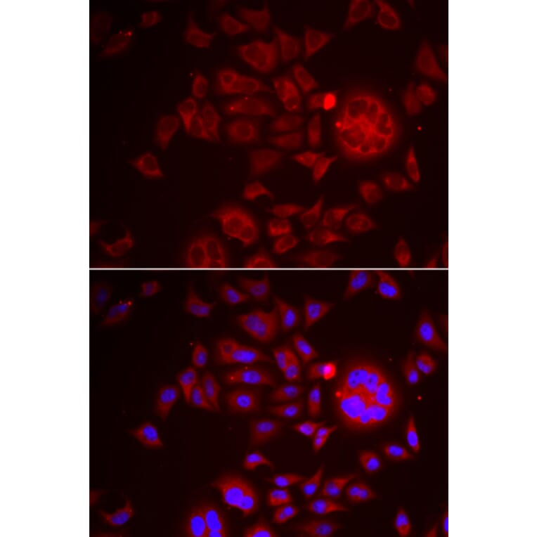 Immunofluorescence - Anti-HAI-1 Antibody (A11972) - Antibodies.com