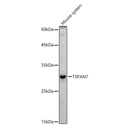 Western Blot - Anti-TALLA-1 Antibody (A11973) - Antibodies.com