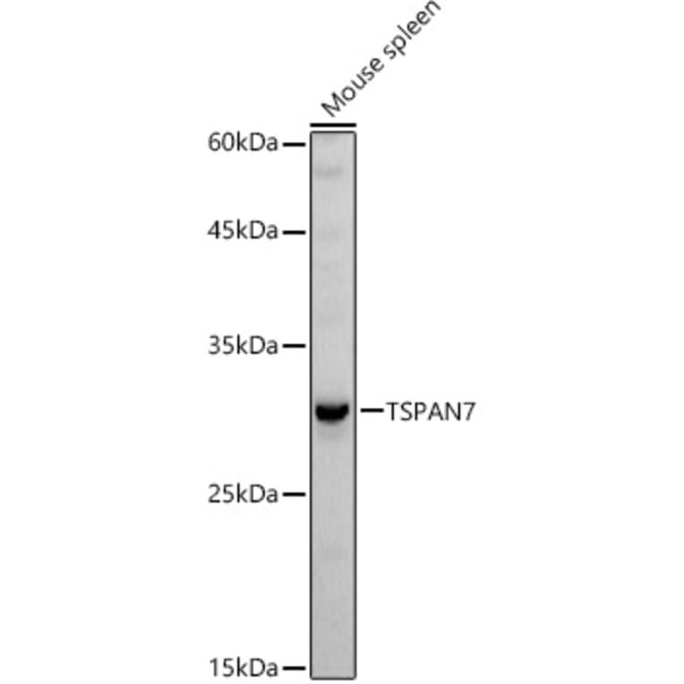 Western Blot - Anti-TALLA-1 Antibody (A11973) - Antibodies.com