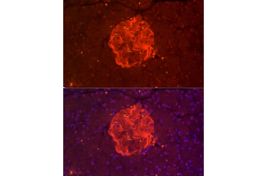 Immunofluorescence - Anti-TALLA-1 Antibody (A11973) - Antibodies.com