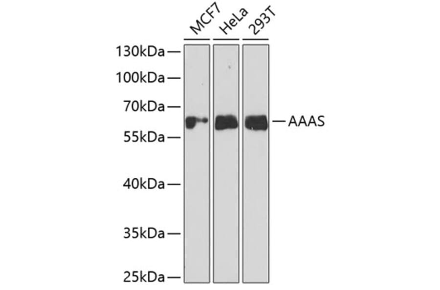 Western Blot - Anti-AAAS Antibody (A11974) - Antibodies.com