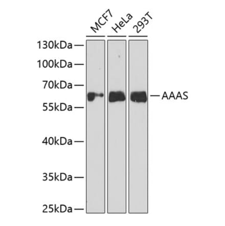 Western Blot - Anti-AAAS Antibody (A11974) - Antibodies.com