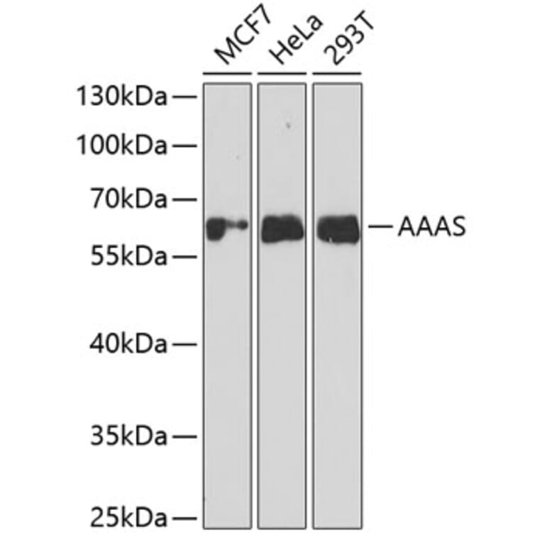 Western Blot - Anti-AAAS Antibody (A11974) - Antibodies.com