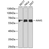 Western Blot - Anti-AAAS Antibody (A11974) - Antibodies.com