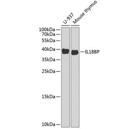 Western Blot - Anti-IL-18BP Antibody (A11975) - Antibodies.com