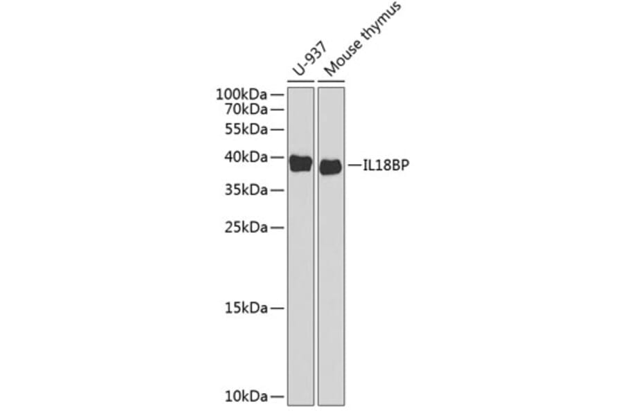 Western Blot - Anti-IL-18BP Antibody (A11975) - Antibodies.com