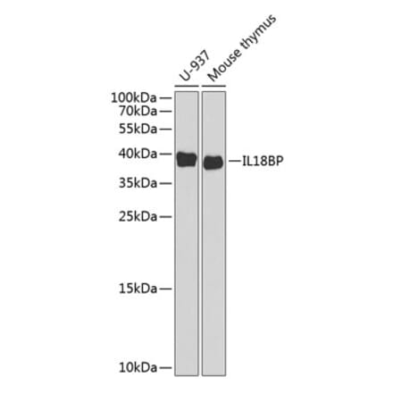 Western Blot - Anti-IL-18BP Antibody (A11975) - Antibodies.com