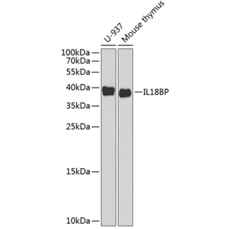 Western Blot - Anti-IL-18BP Antibody (A11975) - Antibodies.com